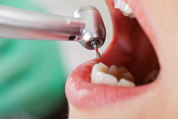 Best Same-Day Emergency Dentist in Oak Hill, OH